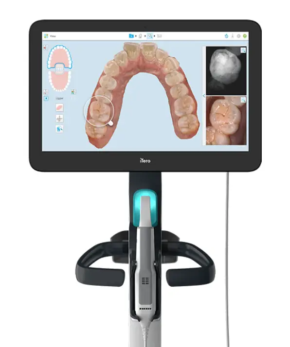 Itero Element 5D Plus machine